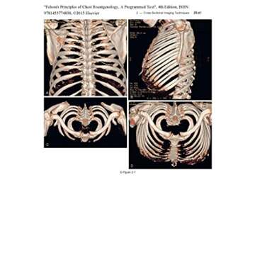 Master Chest Radiography with Felson's Principles of Chest Roentgenology