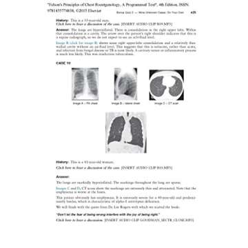 Master Chest Radiography with Felson's Principles of Chest Roentgenology