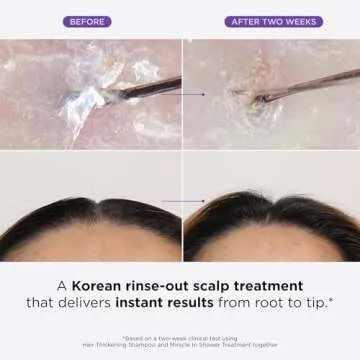 Dr. Groot Scalp Revitalizing Solution Regrowth Bundle for Hair Loss, Korean Hair Care, Hair Thickening Shampoo & Miracle In Shower Scalp Treatment Set for Thinning, Dry, Frizzy Hair