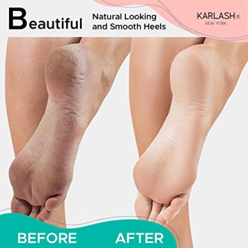 Karlash Pumice Stone for Feet Care - Pack of 2
