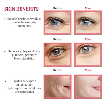 Elevate Skincare with Ice Globes for Facials