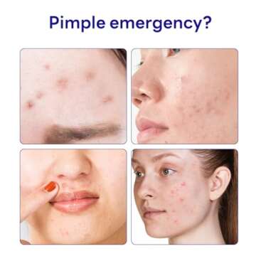 MEDIHEAL Derma Clear Madecassoside Blemish Spot Patch (44 Counts) - Acne Spot Protection, Spot Fast Healing with Madecassoside & Niacinamide