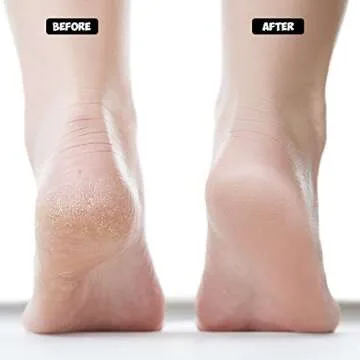 Nado Care 4 Pairs Heels Moisturizing Socks for Dry Cracked Heels Repair - Moisturizing Gel Heel Sleeves Open Toe Comfy Socks Day Night - Pink, Blue, Grey and Black