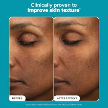 Paula’s Choice 6% Mandelic Acid + 2% Lactic Acid Exfoliant, Gentle Daily AHA Exfoliation for Discoloration, Bumpy Texture & Radiance, for Sensitive Skin, Fragrance-Free & Paraben-Free, 3 Fl. Oz.