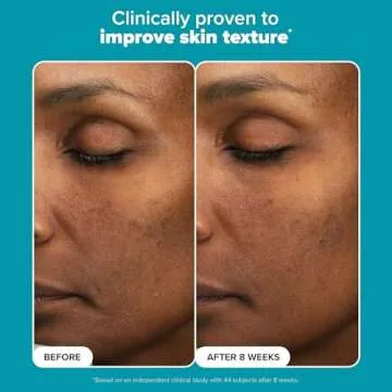 Paula’s Choice 6% Mandelic Acid + 2% Lactic Acid Exfoliant, Gentle Daily AHA Exfoliation for Discoloration, Bumpy Texture & Radiance, for Sensitive Skin, Fragrance-Free & Paraben-Free, 3 Fl. Oz.