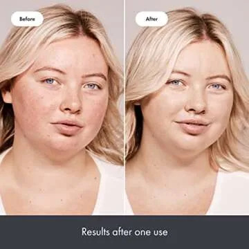 Hero Cosmetics Rescue Balm for Redness Correction