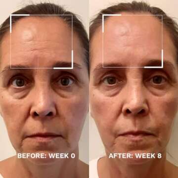 City Beauty Skin-Lifting Booster - Anti-Aging Booster Serum for Face - Lift & Tighten - Sagging Skin...