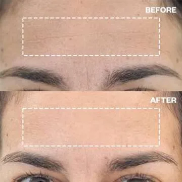 Wrinkles Schminkles Forehead Wrinkle Patches - Reusable Silicone Smoothing Pads for Brow Lift, Wrinkle Smoothers, Reduce Frown Lines & Face Lift (2 Pack)