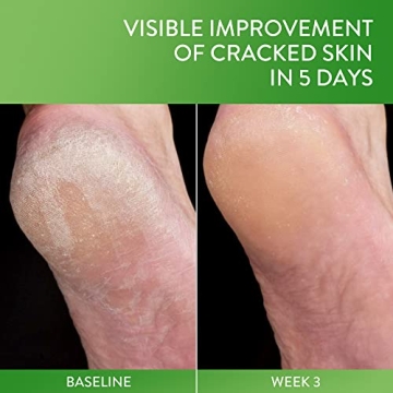 Cetaphil Cracked Skin Repair Balm for Rough Sensitive Skin