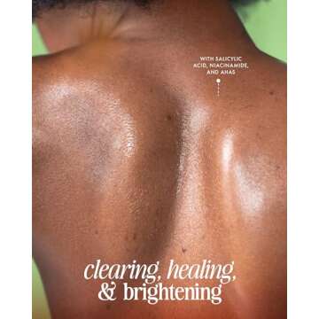 Truly Beauty Cherry Jelly Body Acne Wash with Soothing Cherry Niacinamide, Hydrating Allantoin, & Ma...