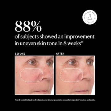 Naturium Vitamin C Super Serum Plus for Brighter, Smoother Skin