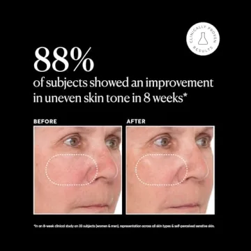 Naturium Vitamin C Super Serum Plus for Brighter, Smoother Skin