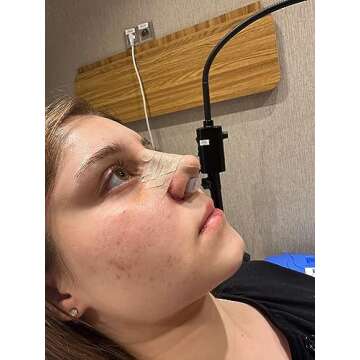 Nostril Retainer for Rhinoplasty Recovery Aid