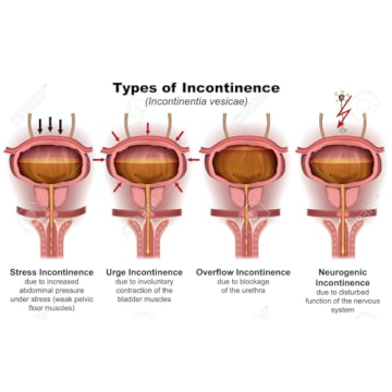 Herbal Bladder Control Supplement for Men & Women