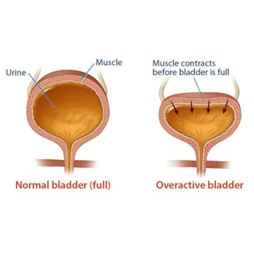 Herbal Bladder Control Supplement for Men & Women