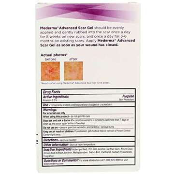 Mederma Advanced Scar Gel, 1.76 oz (50 g)