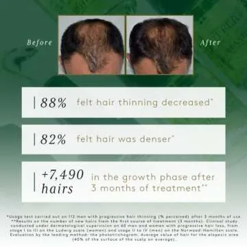 René Furterer TRIPHASIC Progressive Concentrated Serum - Hereditary & Hormonal Thinning Hair - Receding Hairline - Drug-Free - 8 ct., 30-Day Supply