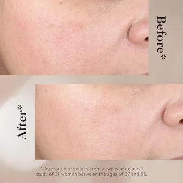 Goop Beauty Glycolic Acid Overnight Peel for Radiant Skin