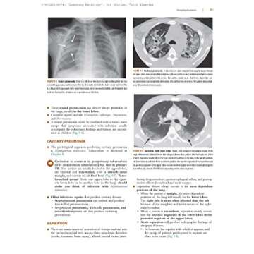 Learning Radiology: Recognizing the Basics