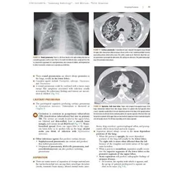 Learning Radiology: Recognizing the Basics