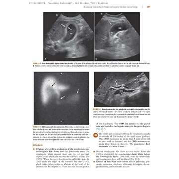 Learning Radiology: Recognizing the Basics