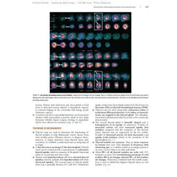 Learning Radiology: Recognizing the Basics