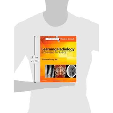 Learning Radiology: Recognizing the Basics