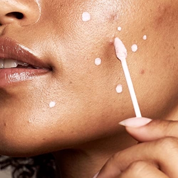 Kate Somerville EradiKate 10% Sulfur BHA Acne Treatment