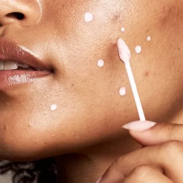 Kate Somerville EradiKate 10% Sulfur BHA Acne Treatment