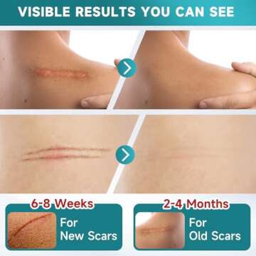 Pumkot Silicone Scar Sheets for Effective Scar Management