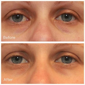 Murad Vita-C Dark Circle Eye Serum Brightening Treatment