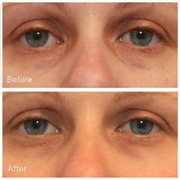 Murad Vita-C Dark Circle Eye Serum Brightening Treatment