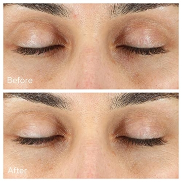 Murad Vita-C Dark Circle Eye Serum Brightening Treatment