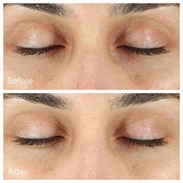 Murad Vita-C Dark Circle Eye Serum Brightening Treatment