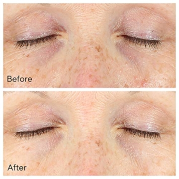 Murad Vita-C Dark Circle Eye Serum Brightening Treatment