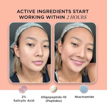 ZitSticka Extra Strength Killa Acne Patches for Face - World's Most Potent Pimple Patch with Fast-Acting Microdarts - Starts Working within 2 Hours for Deep, Early-Stage Zits & Blemish - 4 Count