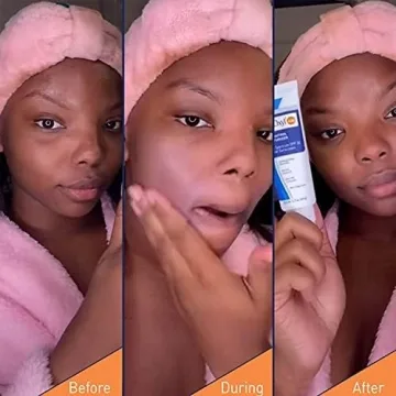 PanOxyl Oil Control Daily Facial Moisturizer with SPF 30