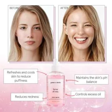 Grace & Stella Premium Rose Water Facial Spray for All Skin Types