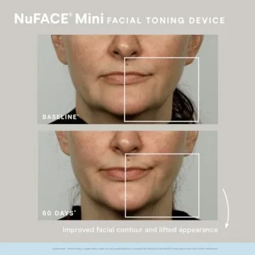 NuFACE MINI Starter Kit Portable Microcurrent Facial Device