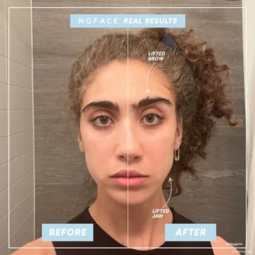 NuFACE MINI Starter Kit Portable Microcurrent Facial Device