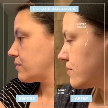 NuFACE MINI Starter Kit Portable Microcurrent Facial Device