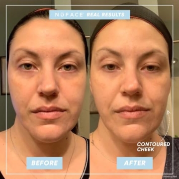 NuFACE MINI Starter Kit Portable Microcurrent Facial Device