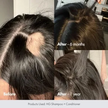 BondiBoost HG Conditioner for Fuller, Healthier Hair