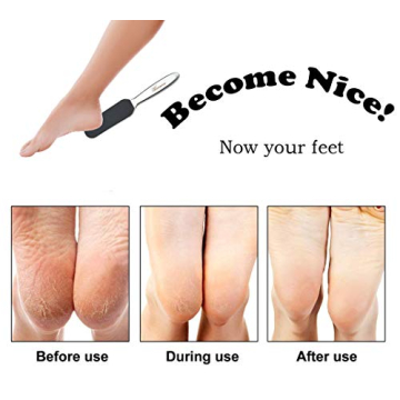 Homeve Foot File for Exquisite Foot Care with Replaceable Pads