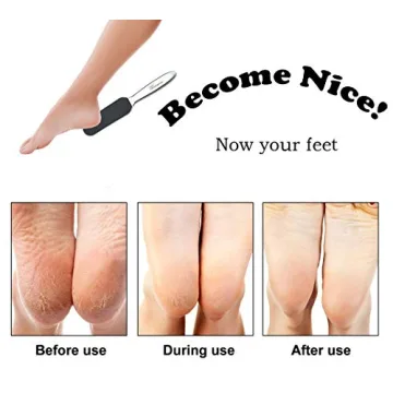 Homeve Foot File for Exquisite Foot Care with Replaceable Pads