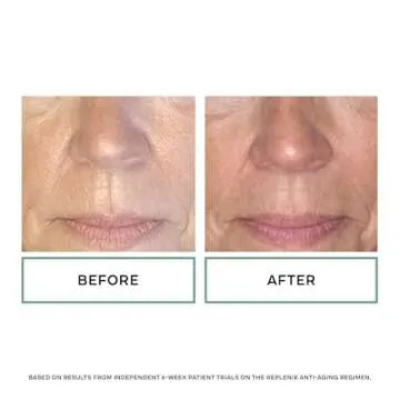 Replenix Anti-Aging Retinol 10X Regenerate Serum, Medical-Grade Quick-Drying Face Serum for Mature Skin (1 fl. oz)