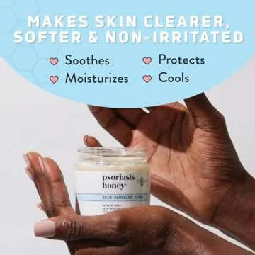 PSORIASIS HONEY Cream - Natural Eczema Treatment 4oz