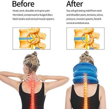 GIMMEF Cervical Neck Traction Device for Pain Relief