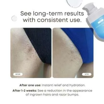 Bushbalm Ingrown Hair Oil - Helps with Ingrown Hair, Underarm Bumps, Soothes Skin, Razor Bumps and P...