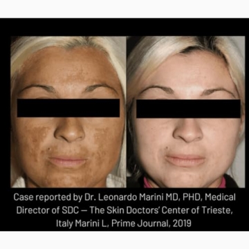 Cyspera Intensive Pigment Corrector - 1.75 Ounce